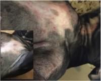 Dry as a Bone - Eczema Treatment